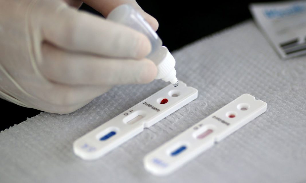 2020-04-28t173535z_1_lynxnpeg3r1y7_rtroptp_4_health-coronavirus-brazil