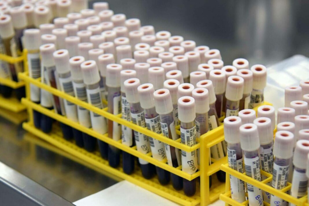 dengue X covid da dengue e da covid-19, pesquisa analisa as relações