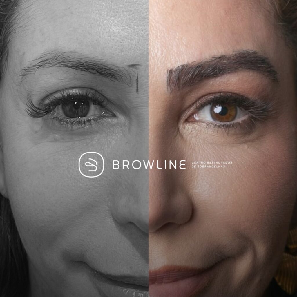 Browline