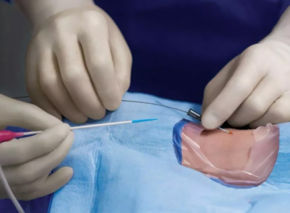 Como Se Preparar Para Cateterismo Cardiaco Dicas Importantes