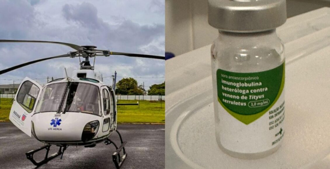 Bebe De Um Ano E Picada Por Escorpiao E Levada De Helicoptero Para Hospital De Maringa