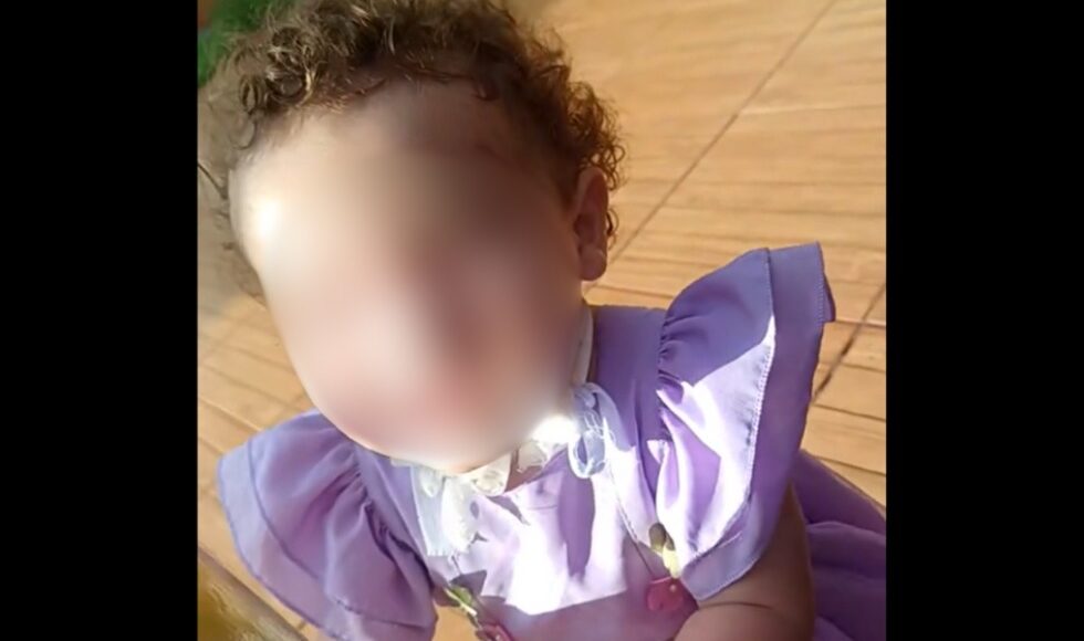 Apos Ataque De Pitbull Dentro De Casa Menina De Sarandi Segue Com Tratamento Familia Pede Doacoes
