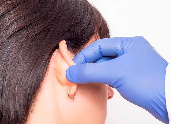 Cirurgia Plastica Na Orelha E1665425568464 17888999