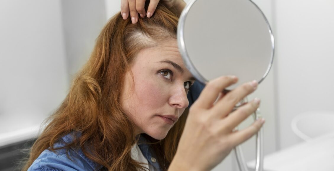 Dermatologista Alerta Para As Causas Mais Comuns Da Queda De Cabelo E Reforca A Importancia Da Terapia Individualizada