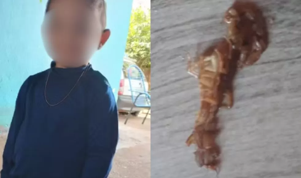 Menino De 3 Anos E Picado Por Escorpiao E Morre Apos Sofrer 33 Paradas Cardiacas No Parana